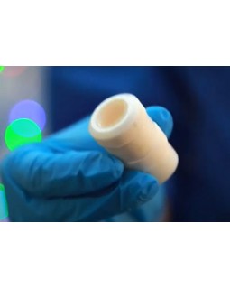 Лазеры для удаления татуировок Nano-Light MV20 надежный неодимовый лазер MedicaLaser-foto5