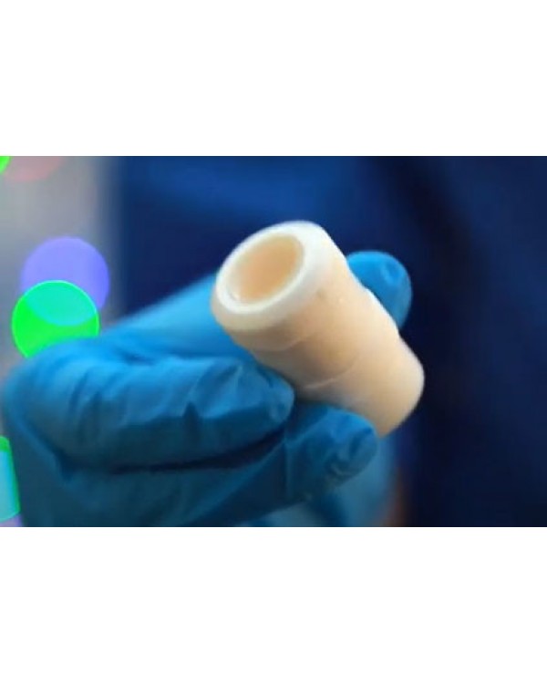 Лазери для видалення татуювань Nano-Light MV20 надійний неодимовий лазер MedicaLaser