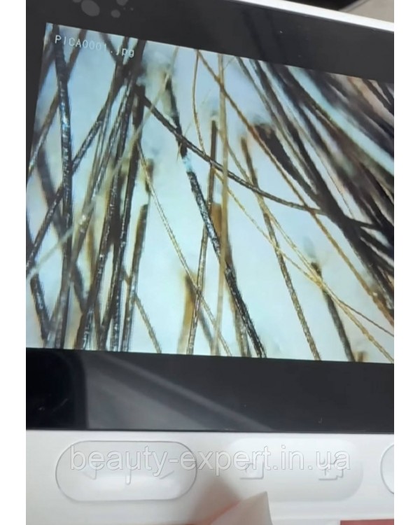 Трихоскоп портативний цифровий з дисплеєм для аналізу шкіри голови та волосся KERATEX NEW
